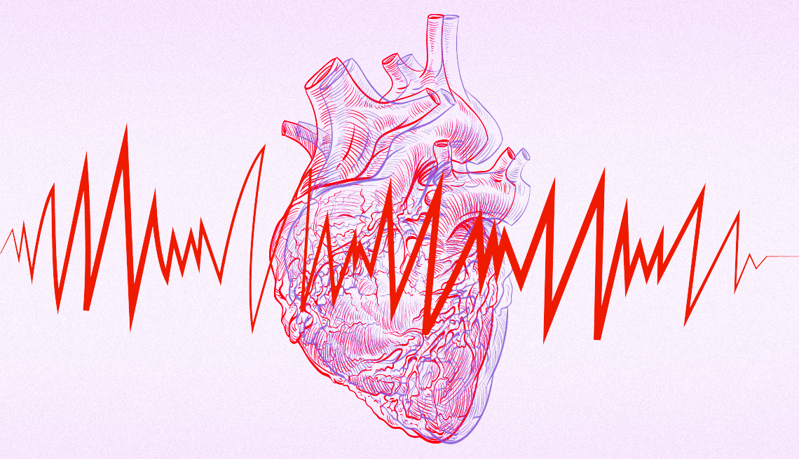 Фібриляція передсердь: основні прояви нерегулярного серцебиття