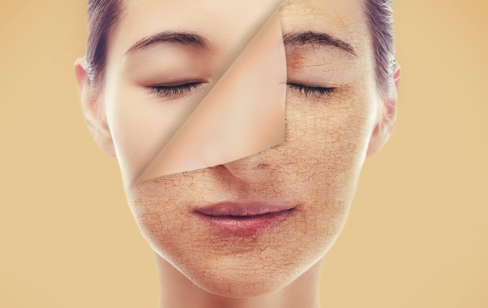 Основні симптоми зневодненої шкіри