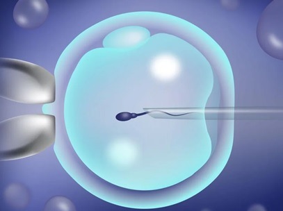 Інтраплазматична ін'єкція сперматозоїда: за та проти