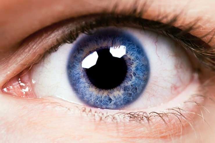 Неврит зорового нерва: основні симптоми запалення
