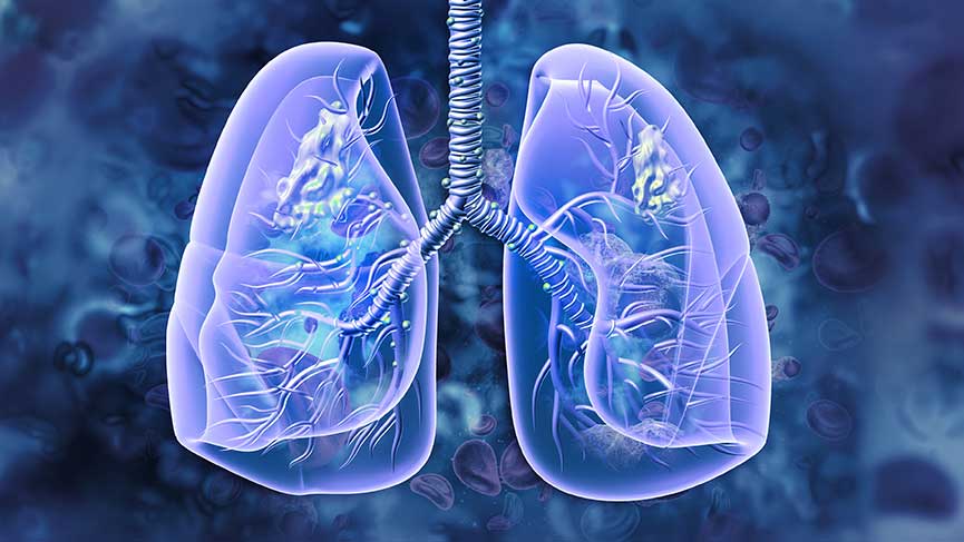 Ателектаз легень: основні симптоми порушення дихання