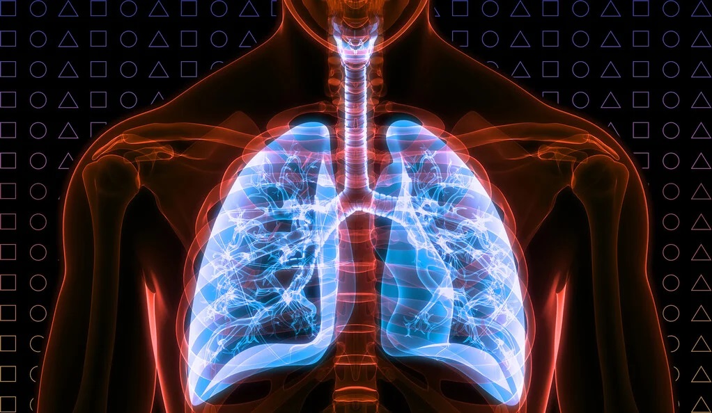Бронхоектатична хвороба: основні симптоми ураження легень