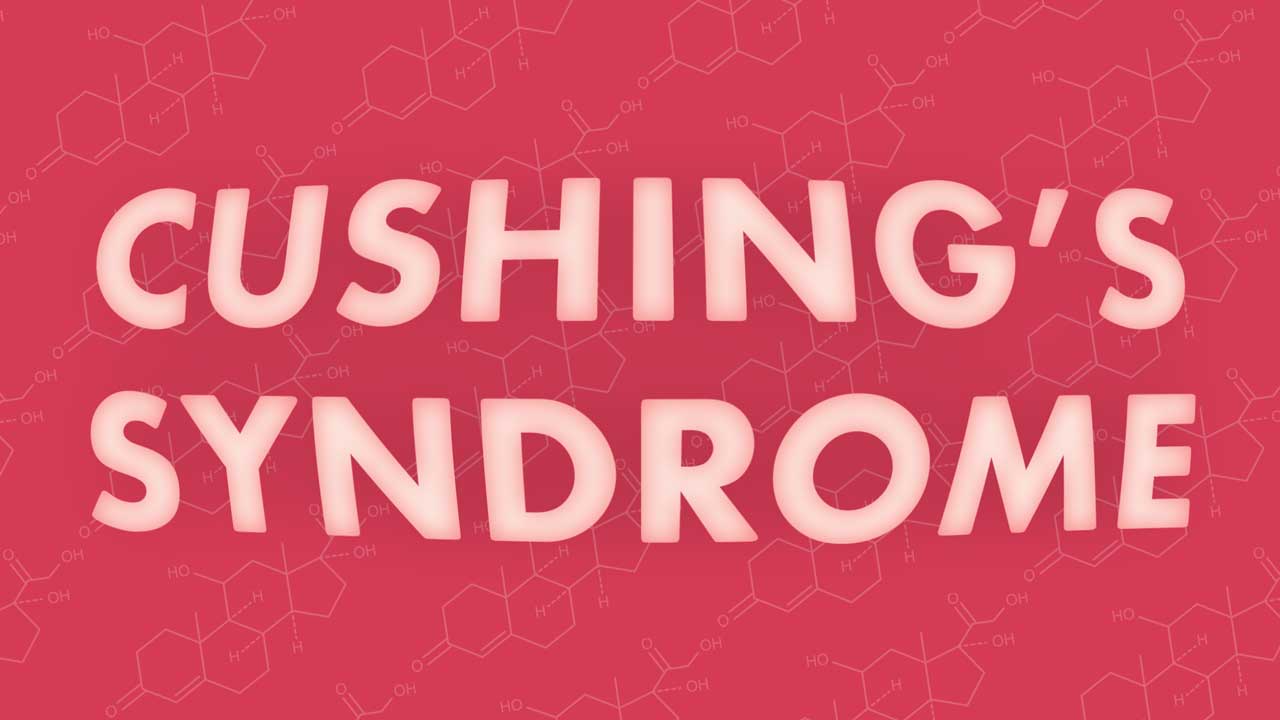 Синдром Кушинга: симптоми надмірного вироблення гормону кортизолу