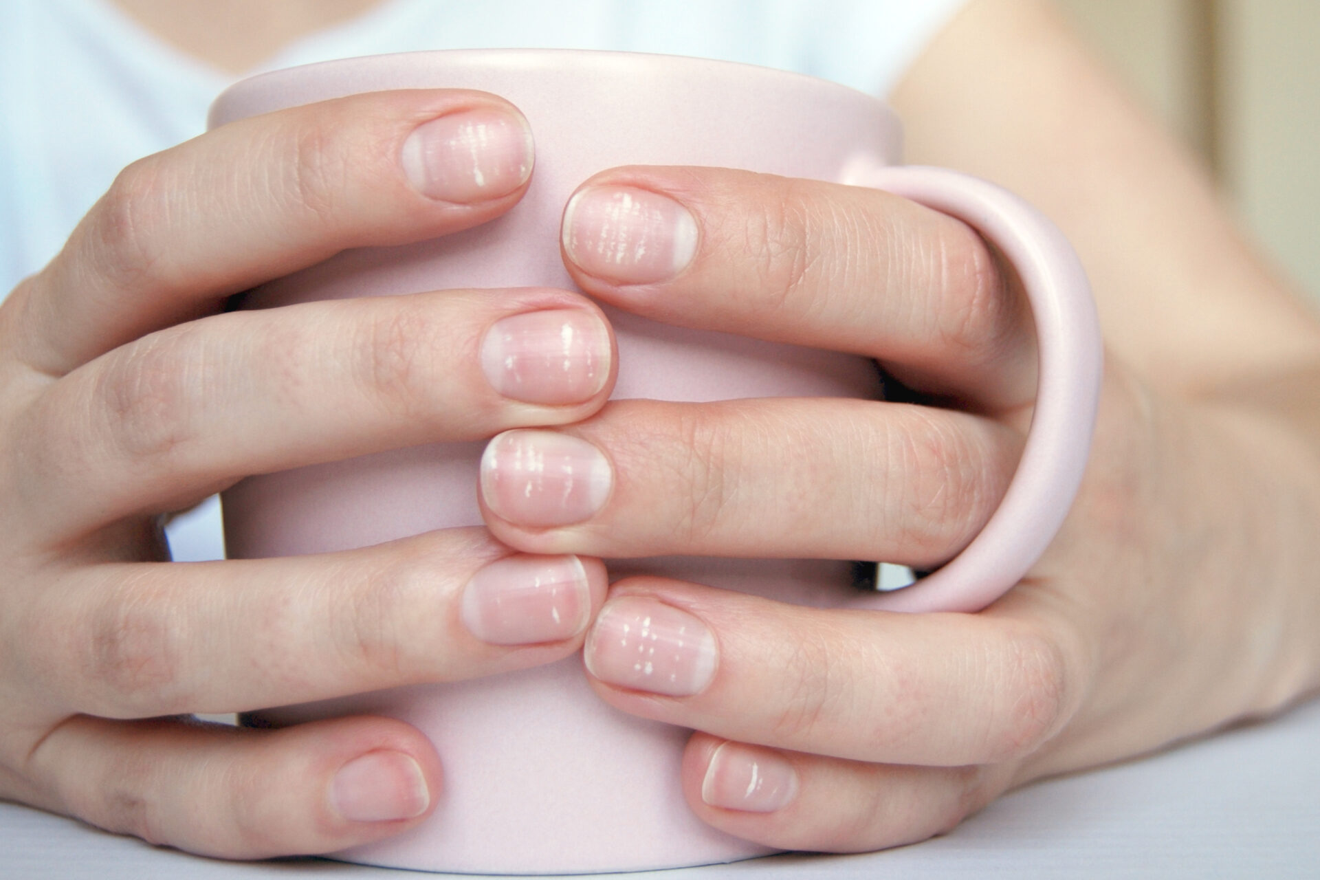 Основні причини появи білих плям на нігтях