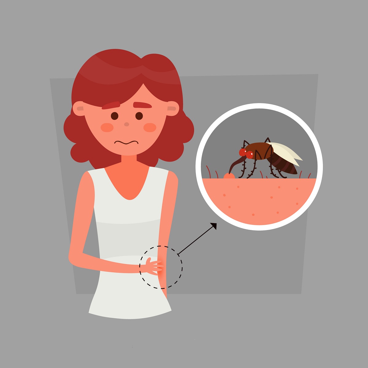 Укус комах: які симптоми будуть свідчити про розвиток алергічної реакції?