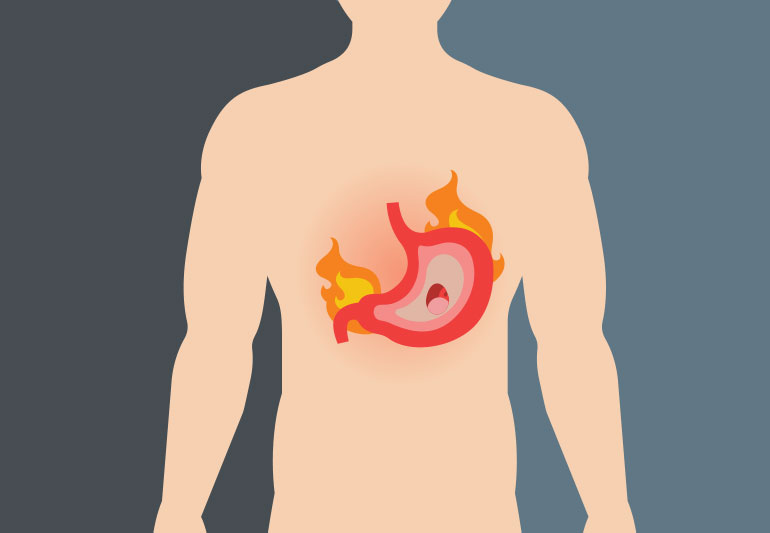 Гастрит: симптоми запалення оболонки шлунка