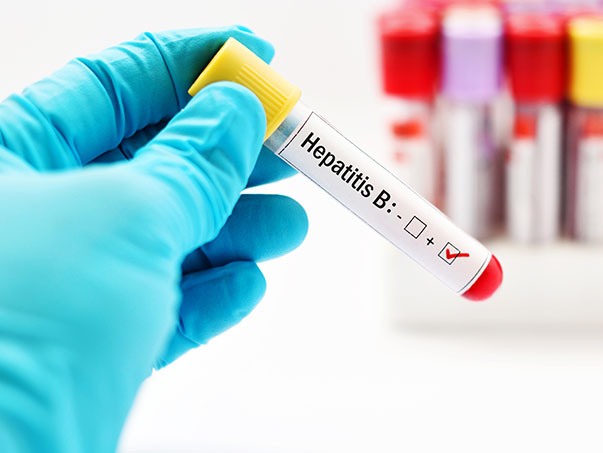 Як і коли проводити тестування на вірусні гепатити сімейним лікарям і терапевтам