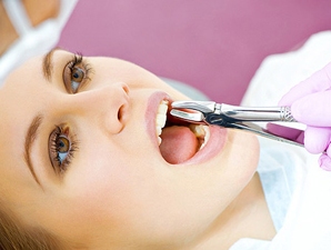 Удаление зуба: показания и противопоказания