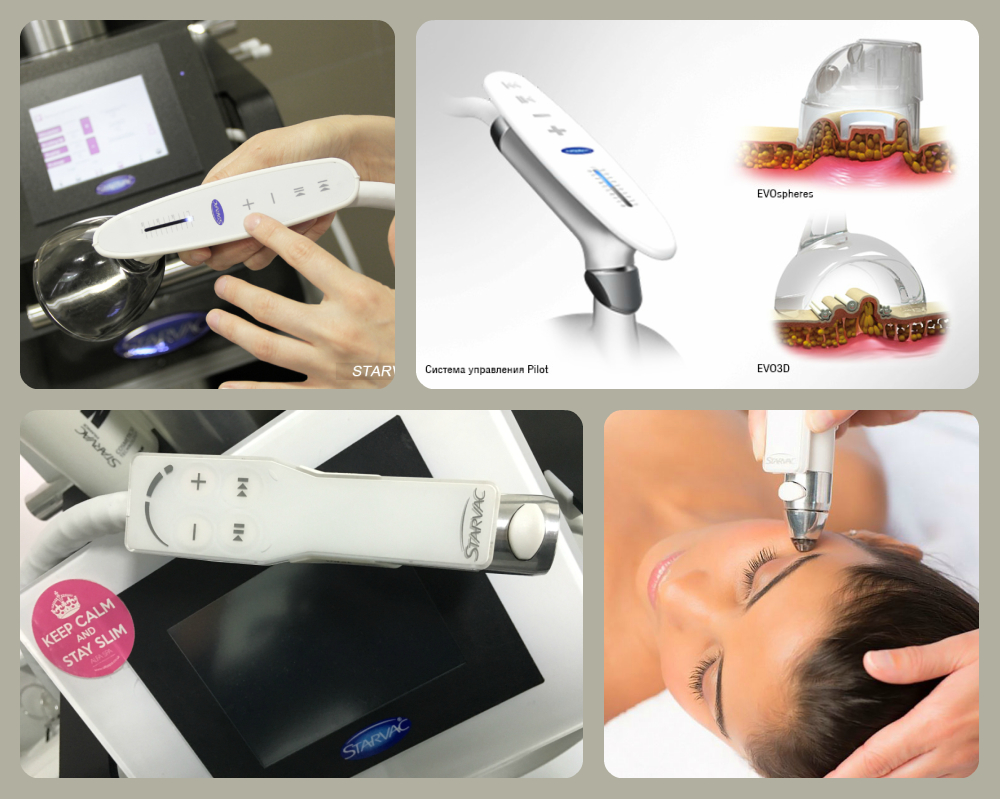 Области применения аппаратов для массажа и прессотерапии Starvac