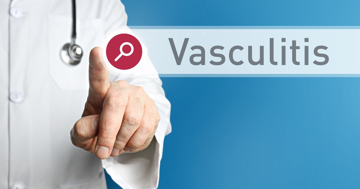 Васкуліт: основні причини запалення стінок судин