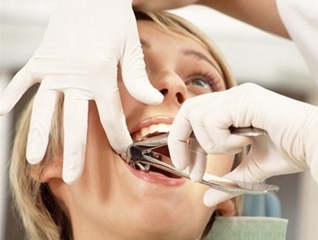 Как подготовиться к удалению зуба? 