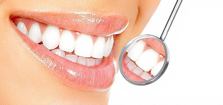 профессиональное отбеливание зубов в Скайклиник - эффективный способ добиться естественной белой улыбки.