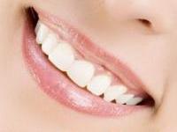 5 способов сделать зубы белее!